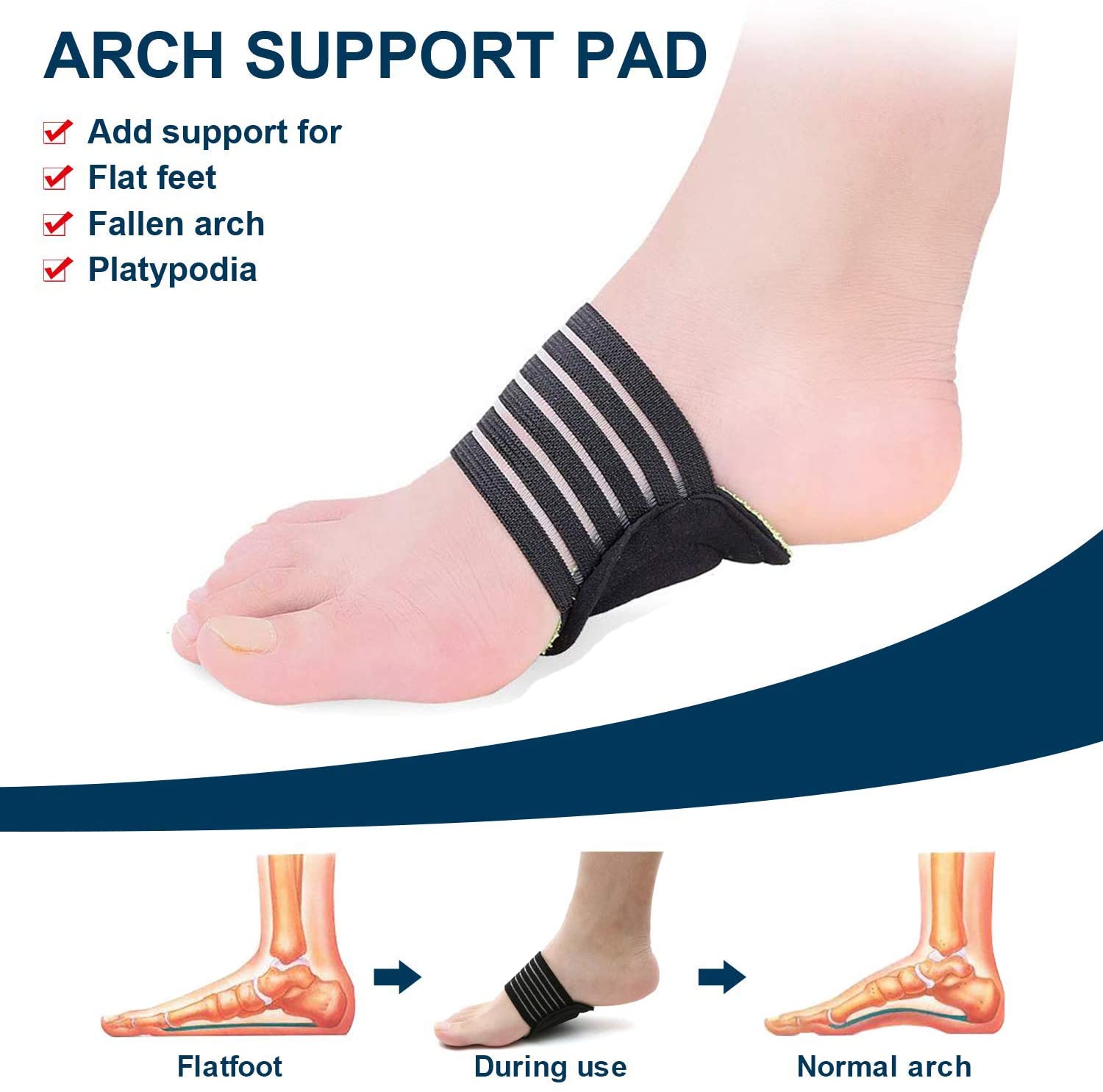 1 x PAIR Plantar Fasciitis Extra Thick Cushioned Compression Arch Support with More Padding  Ireland